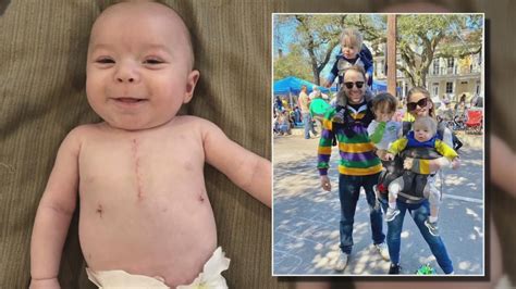 Child Born With A Hole In His Heart Thriving Thanks To Mardi Gras