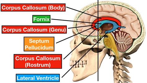 Which Ventricles Are Divided By The Septum Pellucidum Sienna Has Schmidt