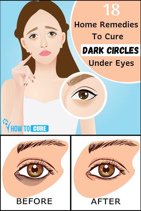 How To Heal A Scratch Under Eye