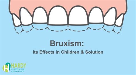 Causes And Effects Of Teeth Grinding Bruxism In Kids And Its