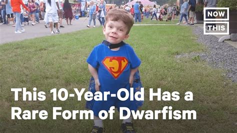 Meet The Only Boy In The World With This Rare Form Of Dwarfism Nowthis Youtube