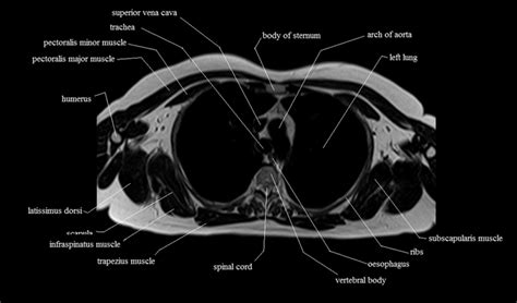 To start, select the radiology button from the hub. Back Muscles Anatomy Ct : Muscles Of The Back Anatomy Stock Photo - Download Image ...