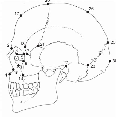 Lateral View Of Skull With Landmark Locations Identified The Numbers