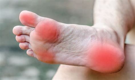 High Cholesterol Symptoms Include Foot Pain Uk