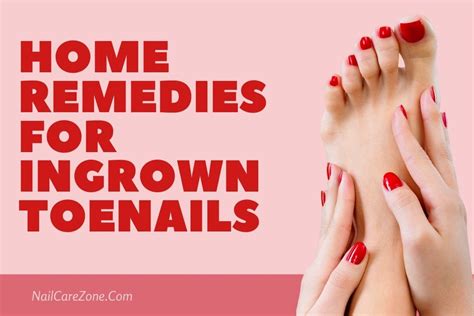 Home Remedies For Ingrown Toenails Three Best Solutions