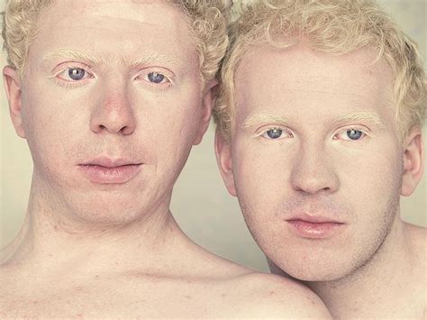 58 Albino People Wholl Mesmerize You With Their Otherworldly Beauty