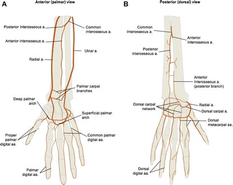 Image Of Accessory Brachial Radial And Ulnar Arteries And Persistent