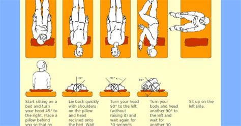 Right Sided Bppv Treatment Physical Therapy Pinterest