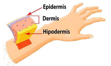Hipodermis