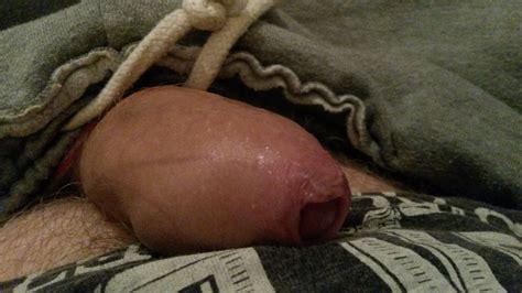 My Tight Foreskin In Trackies Photos Xxx Porn Album