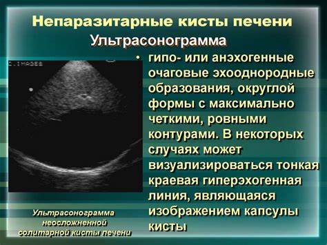 Киста в печени лечение диета Киста Печени Причины И Лечение Диета — Похудение Диета Правильное Питание Киста Печени Причины И Лечение Диета — Похудение Диета Правильное Питание Киста в печени лечение диета