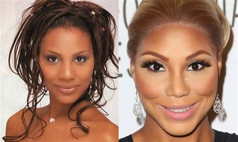 Tamar Braxton Before And After Plastic Surgery 03 Celebrity Plastic