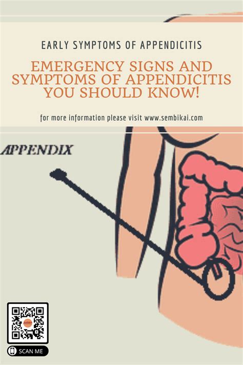 Where Is Your Appendix And Early Signs Of Appendicitis Kulturaupice