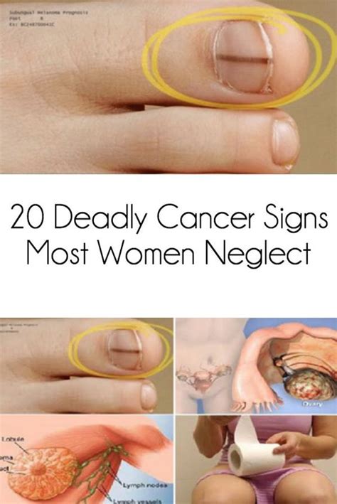 20 Deadly Cancer Symptoms Most Women Ignore Healthytop001
