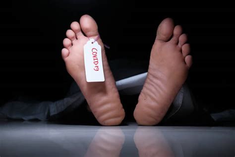 Dead Feet Stock Photos Pictures And Royalty Free Images Istock