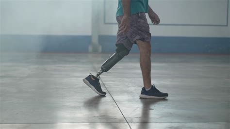 Indoor Ambulation Man With Prosthetic Leg Stock Footage Sbv 348397324