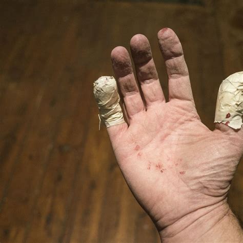 3 Most Common Types Of Hand Injuries Harmony Lab And Safety