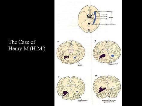 Clinically Relevant Functional Neuroanatomy 2 Neuroanatomy Of Memory