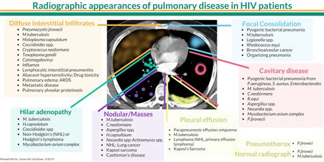Radiographic Appearances Of Pulmonary Diseases In Hiv Aids Grepmed