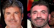 Simon Cowell Removes His Face Fillers After Saying He Went “Too Far ...