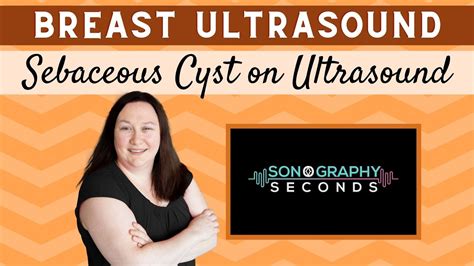 Breast Ultrasound Sebaceous Cyst Sonography In Seconds Series Youtube