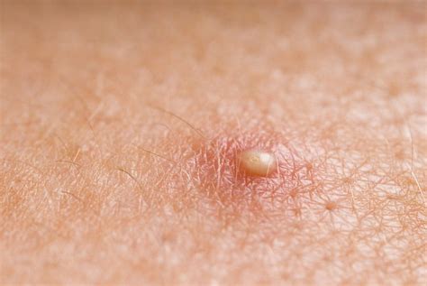 Strange Skin Problems That Could Be A Sign Of A Serious Disease
