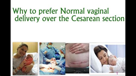 Why Normal Vaginal Delivery Is Better Than A Cesarean Section C Section Dr Ankit Youtube