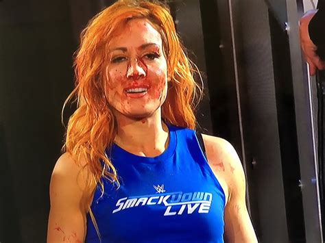 Becky Lynchs Raw Performance Got Fans Pumped For Survivor Series