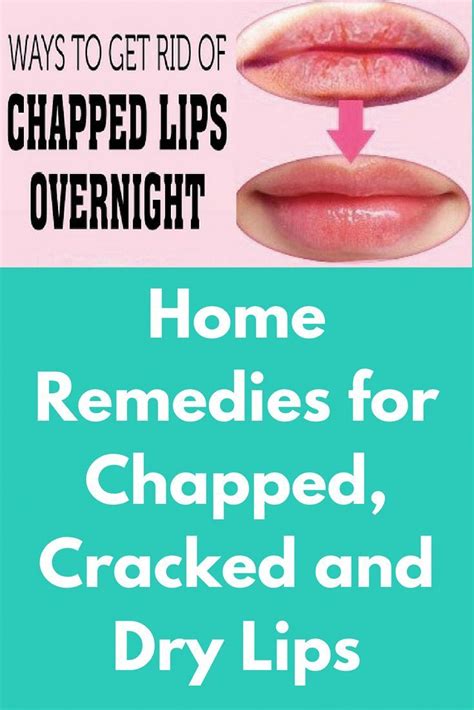 home remedies for chapped cracked and dry lips today i will share a remedy on h dry lips pink