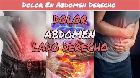 ⚕️🩺 Dolor En Lado Derecho Del Abdomen Apendicitis O Colecistitis