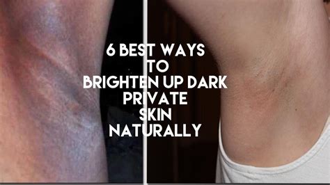 6 Best Ways To Brighten Up Your Dark Private Skin Naturally Youtube