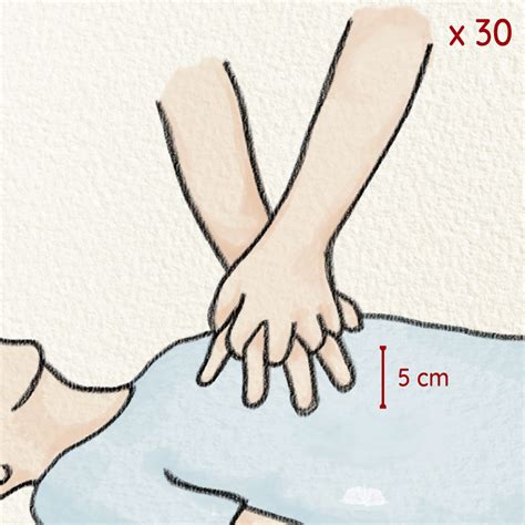 Steps For Children Cpr Mali Pregnancy And Parenting