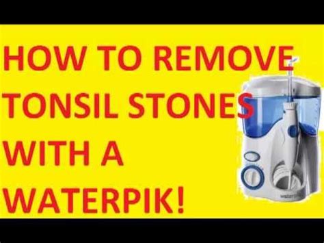 Small as a grain of rice, many people who acquire tonsil stones remain unaware of their presence. Waterpik tonsil stones ♣♣♣ How to remove Tonsil Stones ...