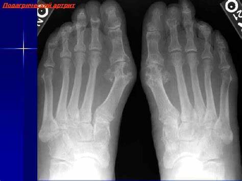 Рентгенодиагностика заболеваний суставов Классификация заболеваний Картинка - Рентгенодиагностика заболеваний суставов Классификация заболеваний