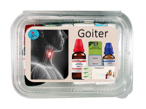 Goiter Treatment Homeopathy Medicines For Swelling Around Neck Homeomart