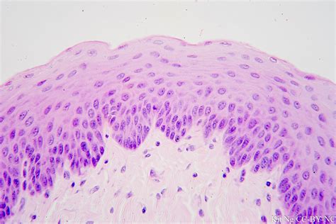 Stratified Squamous Epithelium Non Keratinized Esophagus Histology My The Best Porn Website