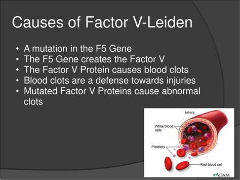 Ppt What Is Factor V Leiden Powerpoint Presentation Free Download