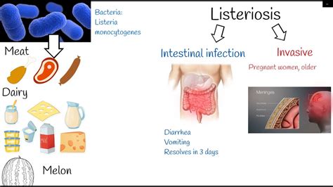 Listeriosis Symptoms And Treatment Listeria Monocytogenes Youtube