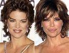 Lisa Rinna Lip Augmentation Plastic Surgery Before and After | Celebie