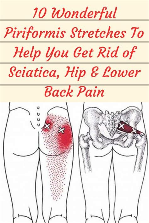 10 Wonderful Piriformis Stretches To Help You Get Rid Of Sciatica Hip