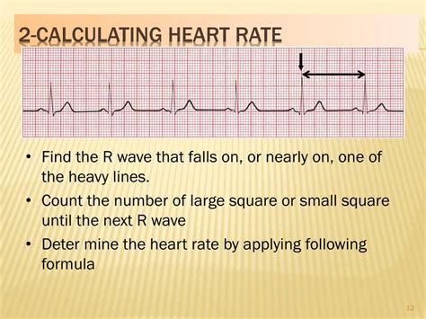 How To Calculate Heart Rate Using Ecg Haiper