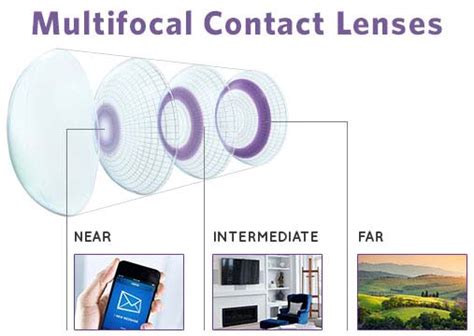 Multifocal Contact Lenses Kodak Lens Vision Centre