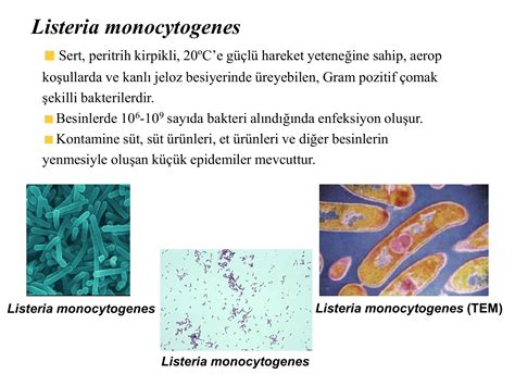 Listeria Monocytogenes Listeria Monocytogenes Bacteria Stock Image