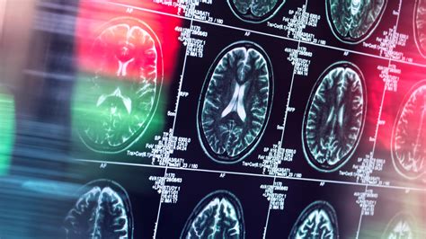 Brain Scans Are Becoming An Increasingly Popular Tool For Dealing With