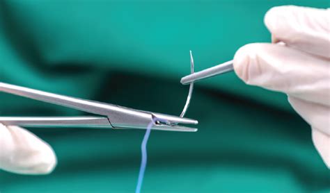 Wound Closure Trays Welcome To Busse Hospital Disposables