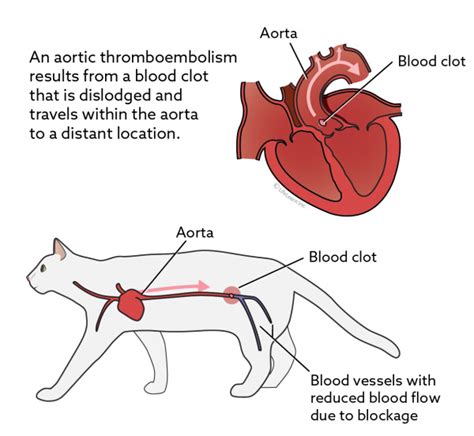 Aortic Thromboembolism In Cats Vca Animal Hospital