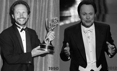 Billy Crystal Plastic Surgery Plastic Surgery Cosmetic Surgery