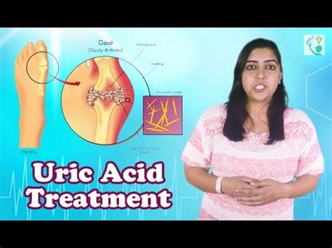 Uric Acid Symptoms Causes And Treatment How To Reduce Uric Acid