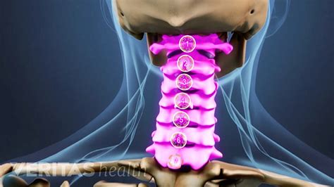 Typical Cervical Vertebrae Labeled Rwanda 24