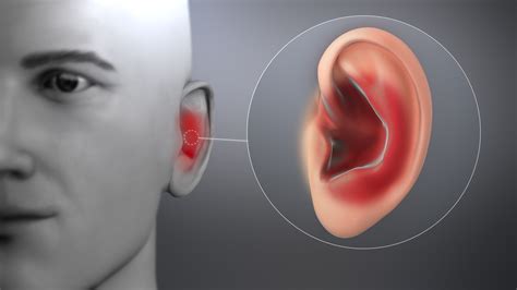 ear infections pictures